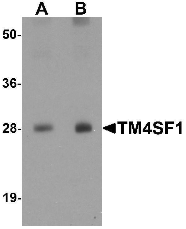 a10368 tm4sf1 primary antibodies wb testing 1