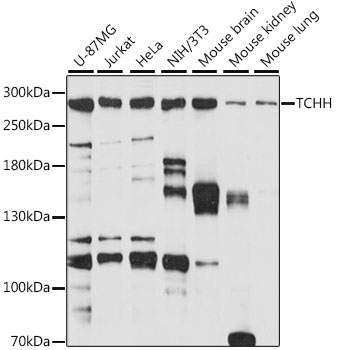 Western blot analysis of extracts of various cell lines, using TCHH antibody