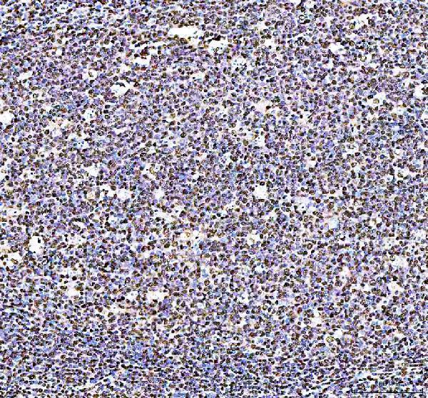 a10377 1 pyhin1 primary antibodies ihc testing 1