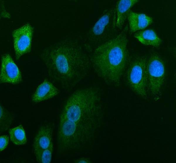 IF analysis of ETNK1 using anti-ETNK1 antibody (A10379)