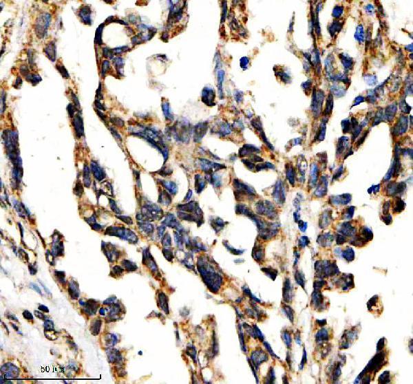IHC analysis of ETNK1 using anti-ETNK1 antibody (A10379)