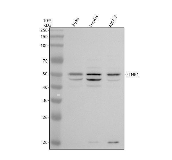 Western blot analysis of ETNK1 using anti-ETNK1 antibody (A10379)