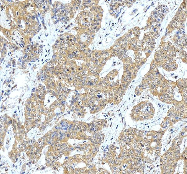 IHC analysis of ATP6V1C1 using anti-ATP6V1C1 antibody (A10380-1)