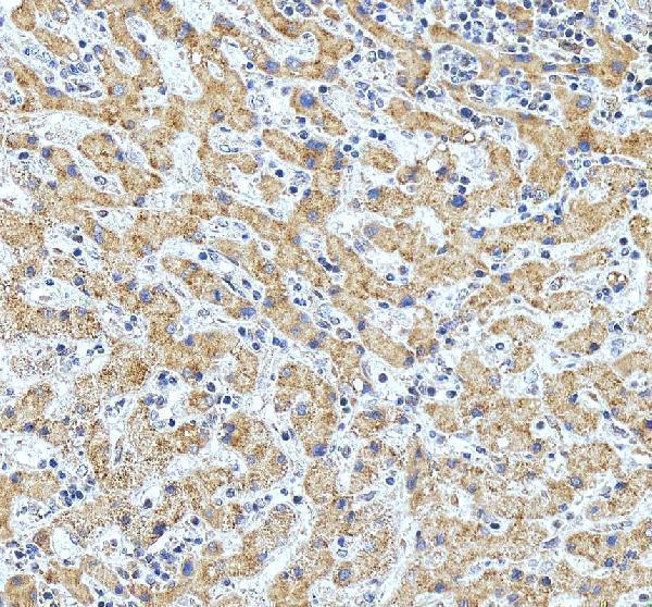 IHC analysis of ATP6V1C1 using anti-ATP6V1C1 antibody (A10380-1)
