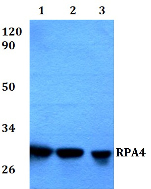 Western blot (WB) analysis of RPA4 polyclonal antibody at 1:500 dilution
Lane1:HEK293T whole cell lysate
Lane2:Raw264