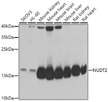 Western blot analysis of extracts of various cell lines, using NUDT2 antibody  at 1:1000 dilution