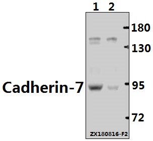 Western blot (WB) analysis of Cadherin-7 (R678) pAb at 1:500 dilution
Lane1:The Brain tissue lysate of Mouse(40ug)
Lane2:The Brain tissue lysate of Rat(40ug)