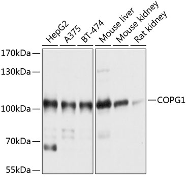 Western blot analysis of extracts of various cell lines, using COPG1 antibody  at 1:1000 dilution