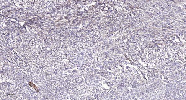 a10395 1 mrpl12 primary antibodies ihc testing 1