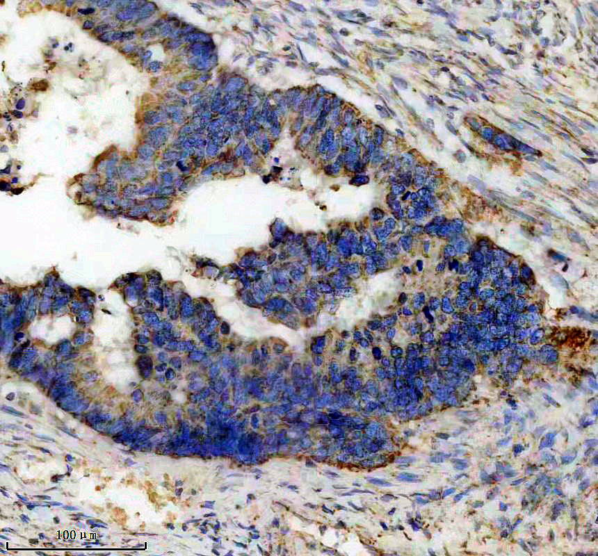 IHC analysis of MRPL12 using anti-MRPL12 antibody (A10395-3)