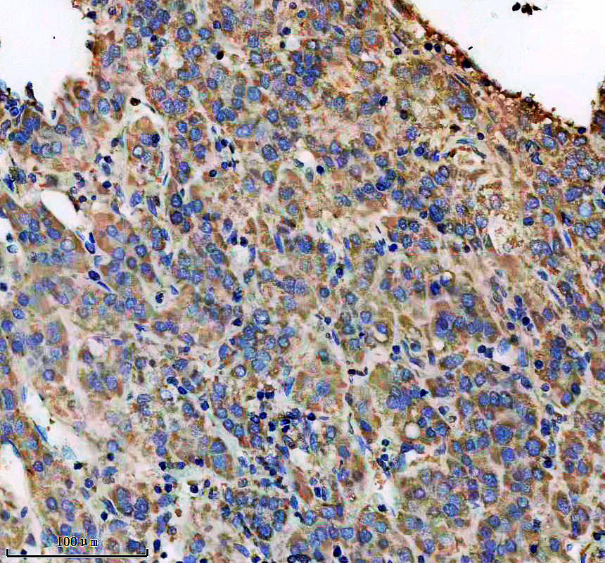 IHC analysis of MRPL12 using anti-MRPL12 antibody (A10395-3)
