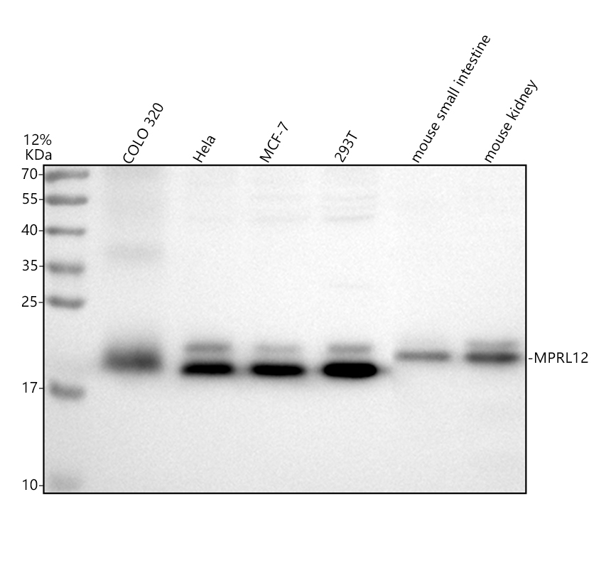 Western blot analysis of MRPL12 using anti-MRPL12 antibody (A10395-3)