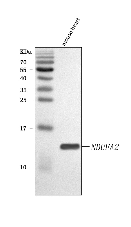 Figure 1. Western blot analysis of NDUFA2 using anti-NDUFA2 antibody (A10396-1). Electrophoresis was performed on a 5-20% SDS-PAGE gel at 70V (Stacking gel) / 90V (Resolving gel) for 2-3 hours. The sample well of each lane was loaded with 30 ug of sample under reducing conditions. Lane 1: mouse heart tissue lysates. After electrophoresis, proteins were transferred to a nitrocellulose membrane at 150 mA for 50-90 minutes. Blocked the membrane with 5% non-fat milk/TBS for 1.5 hour at RT. The membrane was incubated with rabbit anti-NDUFA2 antigen affinity purified polyclonal antibody (Catalog # A10396-1) at 0.5 microg/mL overnight at 4°C, then washed with TBS-0.1%Tween 3 times with 5 minutes each and probed with a goat anti-rabbit IgG-HRP secondary antibody at a dilution of 1:5000 for 1.5 hour at RT. The signal is developed using an Enhanced Chemiluminescent detection (ECL) kit (Catalog # EK1002) with Tanon 5200 system. A specific band was detected for NDUFA2 at approximately 14 kDa. The expected band size for NDUFA2 is at 11 kDa.