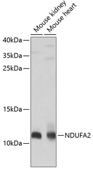 Western blot analysis of extracts of various cell lines, using NDUFA2 antibody  at 1:1000 dilution