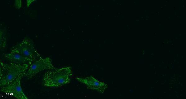 a10397 hsd17b11 primary antibodies if testing 1