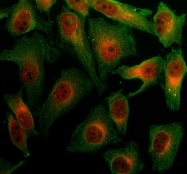 a10398 1 fndc3a primary antibodies if testing 1