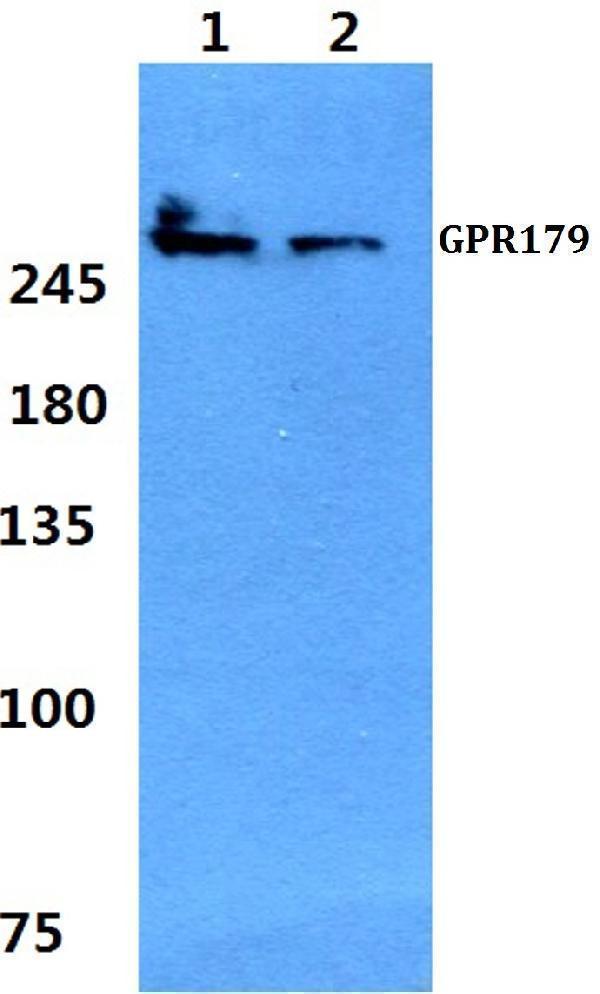 Western blot (WB) analysis of GPR179 polyclonal antibody at 1:500 dilution
Lane1:Hela cell lysate
Lane2:sp2/0 cell lysate