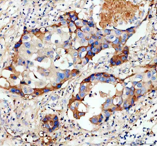 IHC analysis of GJD3 using anti-GJD3 antibody (A10400-1)