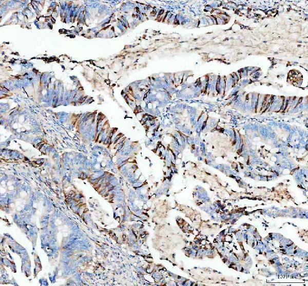 IHC analysis of GJD3 using anti-GJD3 antibody (A10400-1)