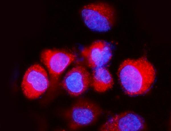 a10401 2 atp6v1a primary antibodies if testing 10