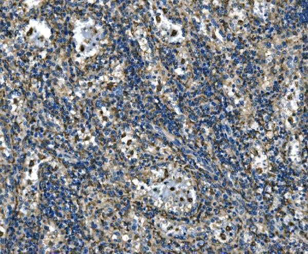 a10401 2 atp6v1a primary antibodies ihc testing 5