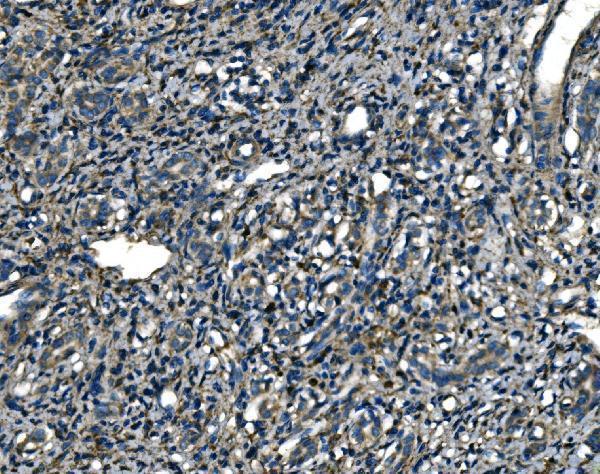 a10401 2 atp6v1a primary antibodies ihc testing 6