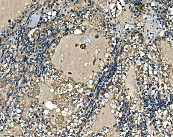 a10401 2 atp6v1a primary antibodies ihc testing 8