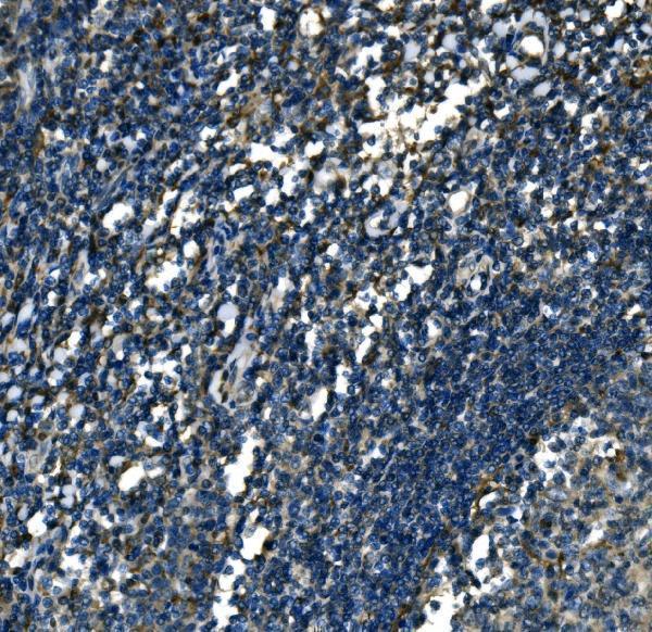 a10401 2 atp6v1a primary antibodies ihc testing 9