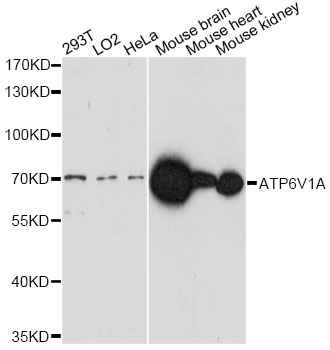 Western blot analysis of extracts of various cell lines, using ATP6V1A antibody