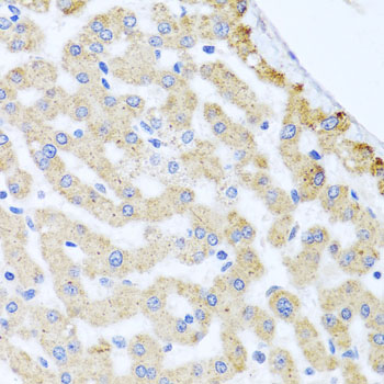 a10402 cetn3 primary antiboties ihc testing 2