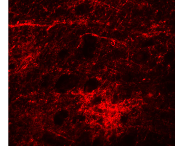 Immunofluorescence of SIPA1L3 in Human Brain cells with SIPA1L3 antibody at 20 μg/mL