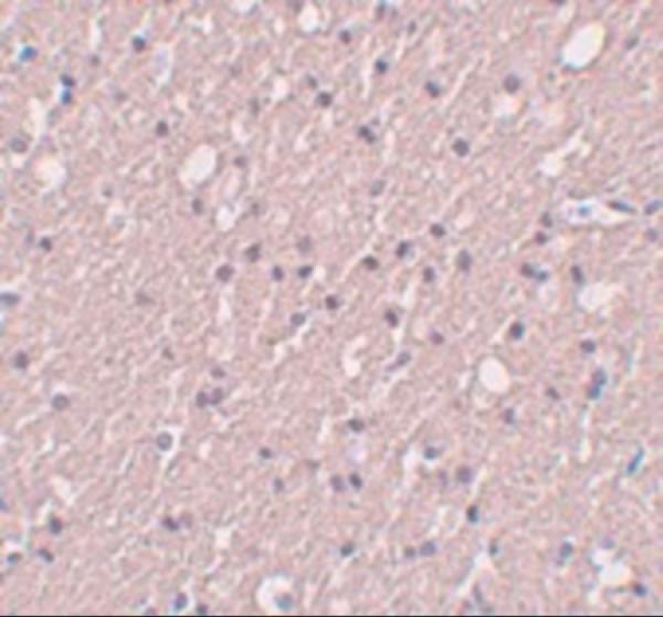 Immunohistochemistry of SIPA1L3 in human brain tissue with SIPA1L3 antibody at 5 μg/mL