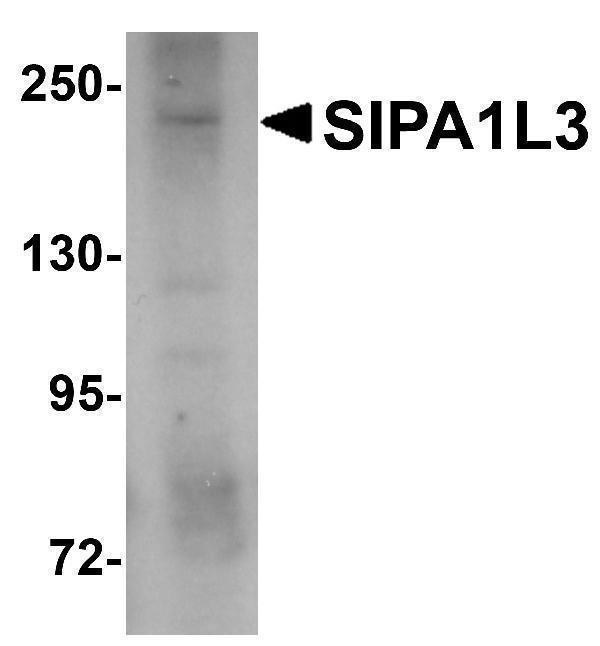 Western blot analysis of SIPA1L3 in SK-N-SH lysate with SIPA1L3 antibody at 1 μg/mL