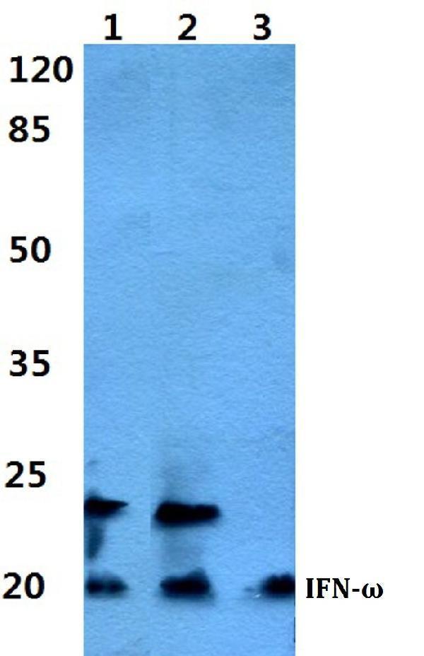 Western blot (WB) analysis of IFN-ω polyclonal antibody at 1:500 dilution
Lane1:HEK293T cell lysate
Lane2:NIH-3T3 cell lysate
Lane3:H9C2 cell lysate