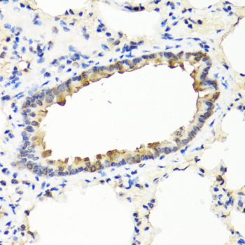 Immunohistochemistry of paraffin-embedded rat lung using IFNW1 antibody at dilution of 1:100 (40x lens)