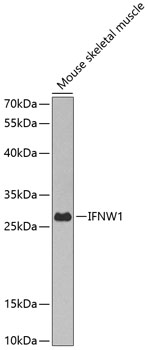 Western blot analysis of extract of various cells, using IFNW1 antibody