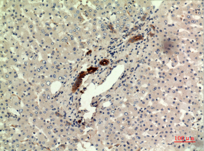 Immunohistochemical analysis of paraffin-embedded human-liver, antibody was diluted at 1:100