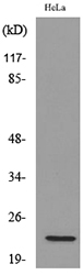 Western blot analysis of lysate from HeLa cells, using IFNW1 Antibody