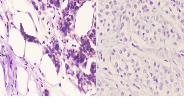 a10420 oxer1 primary antiboties ihc testing 2