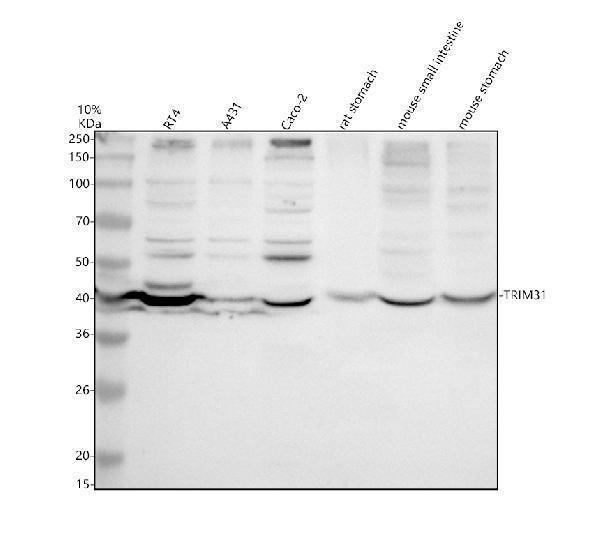 Western blot analysis of TRIM31 using anti-TRIM31 antibody (A10425-1)