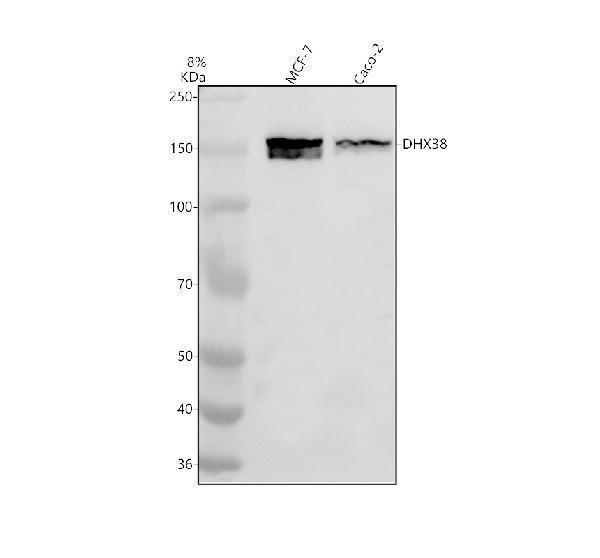 Western blot analysis of DHX38 using anti-DHX38 antibody (A10426-1)