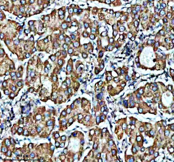a10427 1 pdzd8 primary antibodies ihc testing 1