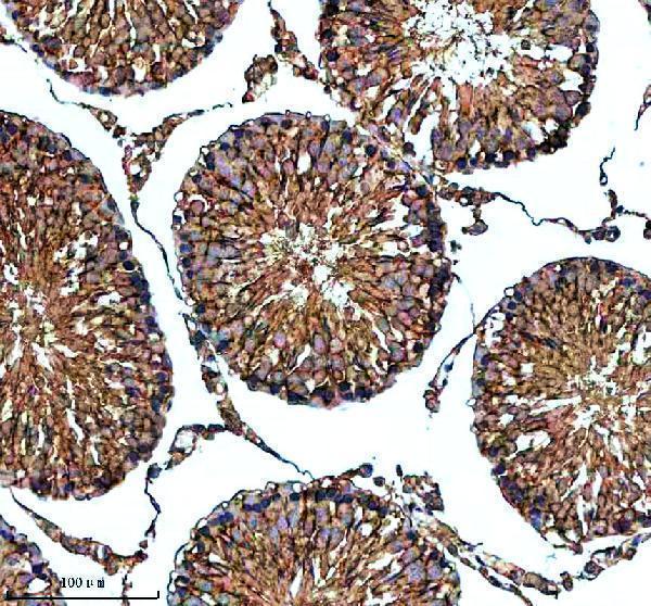 a10427 1 pdzd8 primary antibodies ihc testing 3
