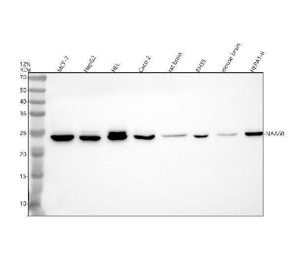 Western blot analysis of NAA60 using anti-NAA60 antibody (A10429-1)