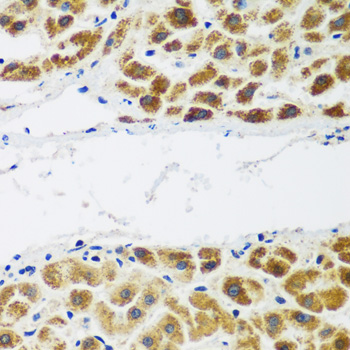 Immunohistochemistry of paraffin-embedded human colon using NAA60 antibody  at dilution of 1:200 