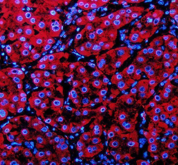 a10430 1 pecr primary antibodies if testing 1