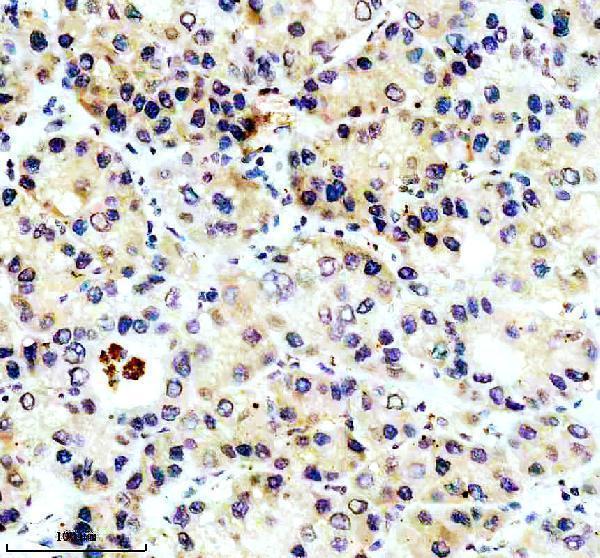 IHC analysis of PECR using anti-PECR antibody (A10430-1)