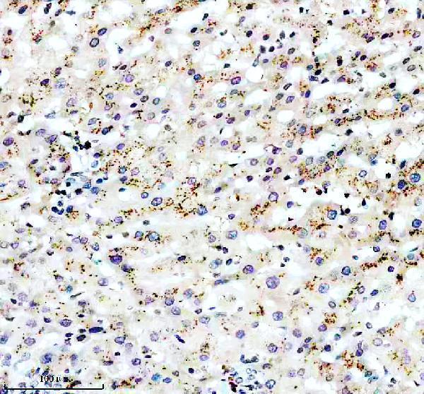 IHC analysis of PECR using anti-PECR antibody (A10430-1)