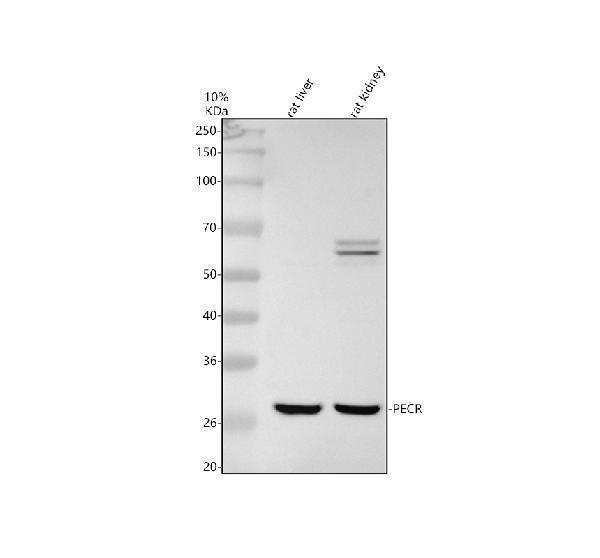 Western blot analysis of PECR using anti-PECR antibody (A10430-1)