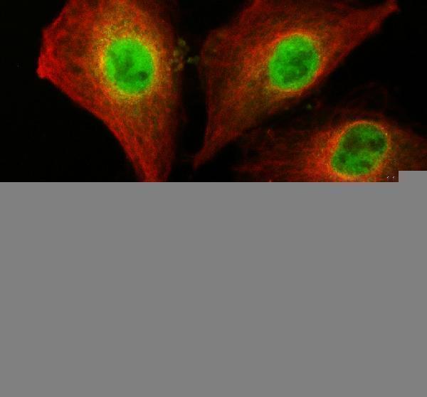 IF analysis of PIP4K2C using anti-PIP4K2C antibody (A10431-1) and anti-Alpha Tubulin antibody (M03989-3)